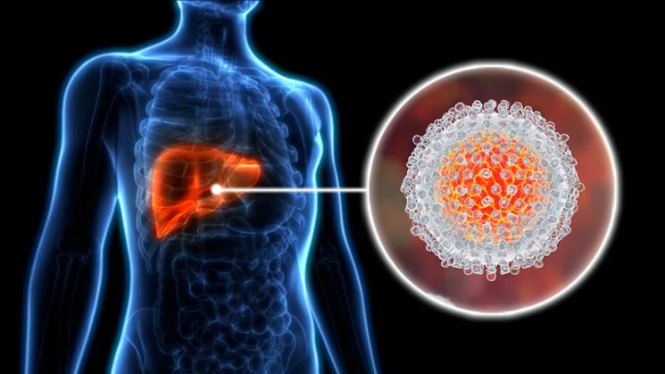 Detectan hepatitis A y E en aguas residuales del AMBA y crece la preocupación por el aumento de casos